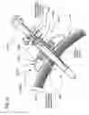 Fig. 32 - METHODS AND DEVICES TO DECREASE TISSUE TRAUMA DURING SURGERY