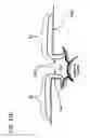 Fig. 37 - METHODS AND DEVICES TO DECREASE TISSUE TRAUMA DURING SURGERY