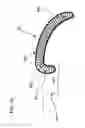 Fig. 42 - METHODS AND DEVICES TO DECREASE TISSUE TRAUMA DURING SURGERY