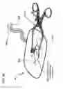 Fig. 46 - METHODS AND DEVICES TO DECREASE TISSUE TRAUMA DURING SURGERY