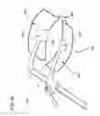 Fig. 48 - METHODS AND DEVICES TO DECREASE TISSUE TRAUMA DURING SURGERY