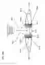 Fig. 58 - METHODS AND DEVICES TO DECREASE TISSUE TRAUMA DURING SURGERY