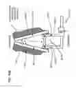 Fig. 59 - METHODS AND DEVICES TO DECREASE TISSUE TRAUMA DURING SURGERY