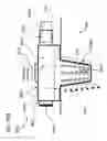 Fig. 63 - METHODS AND DEVICES TO DECREASE TISSUE TRAUMA DURING SURGERY