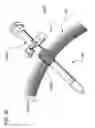 Fig. 64 - METHODS AND DEVICES TO DECREASE TISSUE TRAUMA DURING SURGERY
