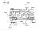 Fig. 94 - METHODS AND DEVICES TO DECREASE TISSUE TRAUMA DURING SURGERY