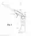Fig. 03 - Vacuum powered saline injection system