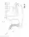Fig. 07 - Vacuum powered saline injection system