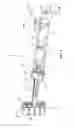 Fig. 02 - Methods of resetting inflation devices