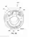 Fig. 23 - Balloon trocar