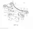 Fig. 03 - Intracranial fixation device