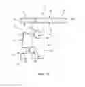 Fig. 04 - Intracranial fixation device
