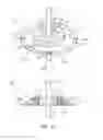 Fig. 08 - Intracranial fixation device