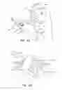 Fig. 07 - Apparatuses and methods for negative pressure wound therapy
