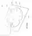 Fig. 80 - Apparatuses and methods for negative pressure wound therapy