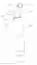 Fig. 15 - Surgical system and method