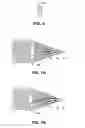 Fig. 04 - Method and apparatus for patterned plasma-mediated laser trephination of the lens capsule and three dimensional phaco-segmentation