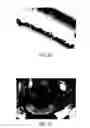 Fig. 11 - Method and apparatus for patterned plasma-mediated laser trephination of the lens capsule and three dimensional phaco-segmentation