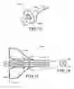 Fig. 38 - Delivery devices with coolable energy emitting assemblies