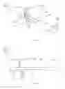 Fig. 49 - Method and appparatus for an intramedullary implant and method of implantation therefor
