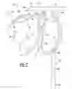 Fig. 08 - Adjustable loop constructs and techniques