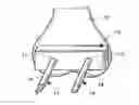 Fig. 01 - Orthopedic jig, pin, and method