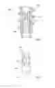 Fig. 07 - System for handling an augmentation implant