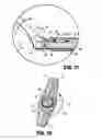 Fig. 20 - Surgical retrieval apparatus for thoracic procedures