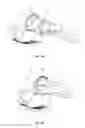 Fig. 03 - MALE CIRCUMCISCION DEVICE AND ASSOCIATED SYSTEMS AND METHODS