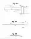 Fig. 05 - Implant tool and improved electrode design for minimally invasive procedure
