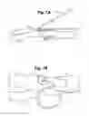 Fig. 07 - Implant tool and improved electrode design for minimally invasive procedure
