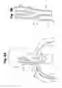 Fig. 08 - Implant tool and improved electrode design for minimally invasive procedure