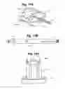 Fig. 11 - Implant tool and improved electrode design for minimally invasive procedure