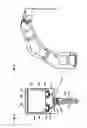 Fig. 03 - Robotic surgery system