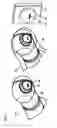 Fig. 06 - Robotic surgery system