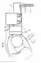 Fig. 19 - Robotic surgery system