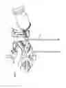 Fig. 23 - Robotic surgery system