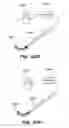 Fig. 172 - Systems and methods for positioning an elongate member inside a body