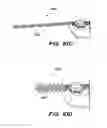 Fig. 83 - Systems and methods for positioning an elongate member inside a body