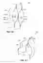 Fig. 84 - Systems and methods for positioning an elongate member inside a body