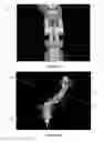 Fig. 05 - Path-following robot