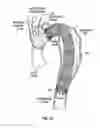Fig. 09 - Multi-fire fastener delivery system and method