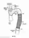 Fig. 10 - Multi-fire fastener delivery system and method