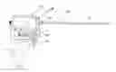 Fig. 01 - MULTI-ACTUATING TRIGGER ANCHOR DELIVERY SYSTEM