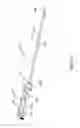 Fig. 05 - MULTI-ACTUATING TRIGGER ANCHOR DELIVERY SYSTEM