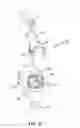 Fig. 13 - MULTI-ACTUATING TRIGGER ANCHOR DELIVERY SYSTEM