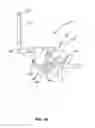 Fig. 18 - MULTI-ACTUATING TRIGGER ANCHOR DELIVERY SYSTEM