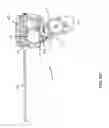 Fig. 36 - MULTI-ACTUATING TRIGGER ANCHOR DELIVERY SYSTEM