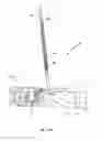 Fig. 38 - MULTI-ACTUATING TRIGGER ANCHOR DELIVERY SYSTEM