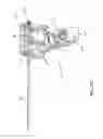 Fig. 47 - MULTI-ACTUATING TRIGGER ANCHOR DELIVERY SYSTEM